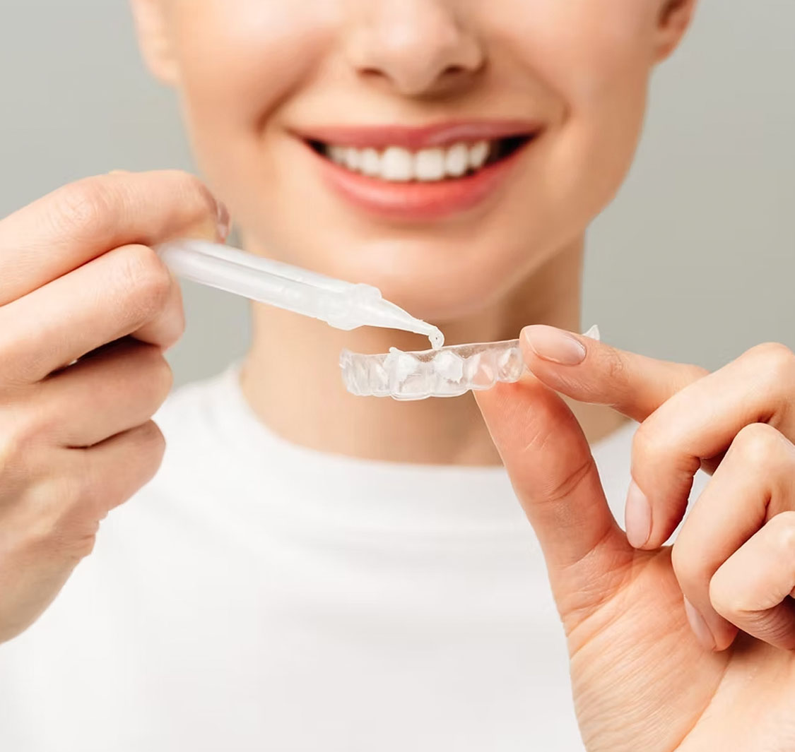 ConfiDent Palm Dentist