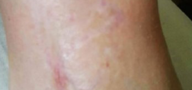 Lazer Tattoo Removal and Beauty Shop