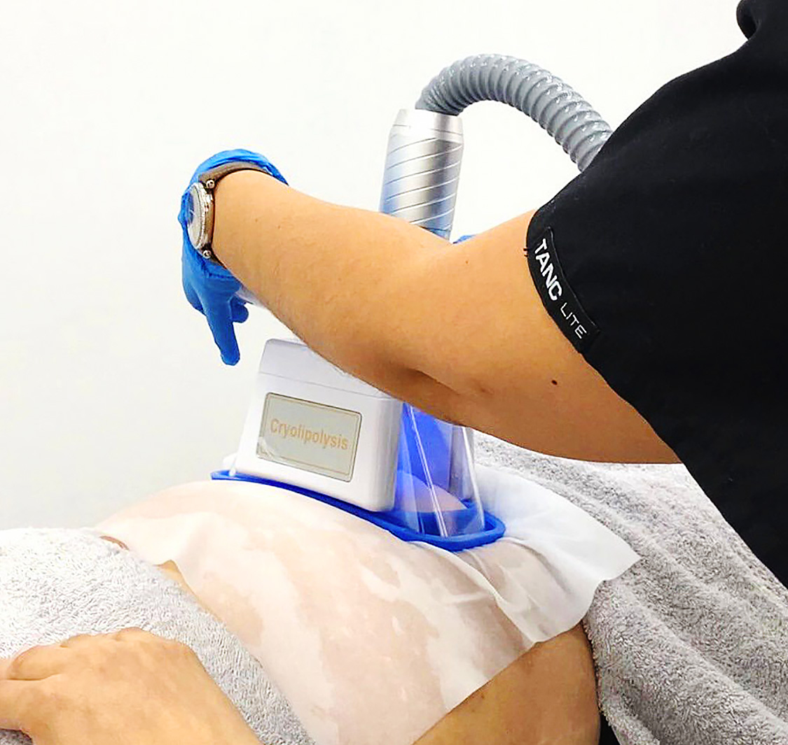 Smart Laser Durbanville